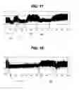 Fig. 13 - Method and apparatus for detecting ischemia