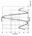 Fig. 05 - Kinematic quantification of gait asymmetry based on bilateral cyclograms