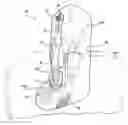 Fig. 01 - Dental hygiene device