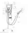 Fig. 02 - Method to control blood and filtrate flowing through an extracorporeal device