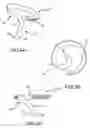 Fig. 05 - Steerable and shapable catheter employing fluid force