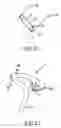 Fig. 12 - Steerable and shapable catheter employing fluid force