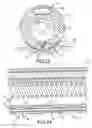 Fig. 13 - Steerable and shapable catheter employing fluid force