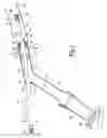 Fig. 02 - Device and method for rectal lavage