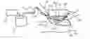 Fig. 01 - Device for the removal of fluids during surgical procedures