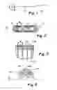 Fig. 02 - Medical devices having full or partial polymer coatings and their methods of manufacture