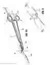Fig. 09 - Electrosurgical instrument which reduces effects to adjacent tissue structures