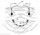 Fig. 01 - System for securing sutures, grafts and soft tissue to bone and periosteum