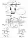 Fig. 07 - System for securing sutures, grafts and soft tissue to bone and periosteum