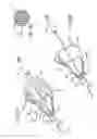 Fig. 07 - Embolic filtering devices