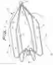 Fig. 02 - Vein filter