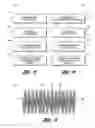 Fig. 09 - Occluding device and method of occluding fluid flow through a body vessel