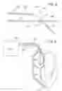 Fig. 07 - Bachmann's bundle electrode for atrial defibrillation