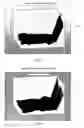 Fig. 18 - System and method for assessment of cardiac electrophysiologic stability and modulation of cardiac oscillations
