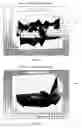 Fig. 20 - System and method for assessment of cardiac electrophysiologic stability and modulation of cardiac oscillations