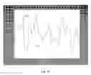 Fig. 23 - System and method for assessment of cardiac electrophysiologic stability and modulation of cardiac oscillations