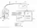 Fig. 01 - Implantable devices and methods using frequency-domain analysis of thoracic signal