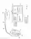 Fig. 02 - Implantable devices and methods using frequency-domain analysis of thoracic signal