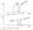 Fig. 09 - Implantable devices and methods using frequency-domain analysis of thoracic signal