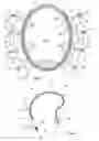 Fig. 02 - Device for applying at least a laser needle on a patient's body