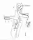 Fig. 02 - Methods for electrosurgical treatment of spinal tissue