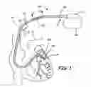 Fig. 02 - Implantable medical device conductor insulation and process for forming