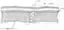 Fig. 01 - Methods and devices for delivering a ventricular stent