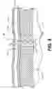 Fig. 09 - Methods and devices for delivering a ventricular stent