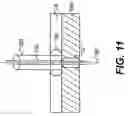 Fig. 12 - Methods and devices for delivering a ventricular stent