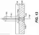 Fig. 14 - Methods and devices for delivering a ventricular stent