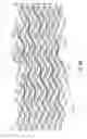 Fig. 09 - Apparatus for a stent having an expandable web structure and delivery system