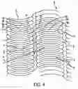 Fig. 05 - Apparatus for a stent having an expandable web structure and delivery system