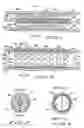Fig. 02 - Expandable stent having plurality of interconnected expansion modules