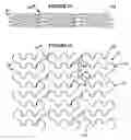 Fig. 08 - Expandable stent having plurality of interconnected expansion modules