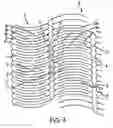 Fig. 05 - Apparatus for a stent having an expandable web structure