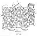 Fig. 06 - Apparatus for a stent having an expandable web structure