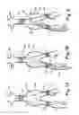 Fig. 02 - Methods, materials and apparatus for deterring or preventing endoleaks following endovascular graft implantation