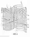 Fig. 05 - Apparatus for a stent having an expandable web structure