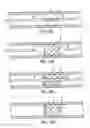 Fig. 11 - Apparatus for a stent having an expandable web structure