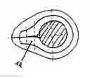Fig. 01 - Implant with an annular base