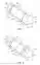 Fig. 09 - Method of repositioning immobile patient in bed using patient positioning aid