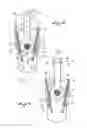 Fig. 05 - Lace blocking device