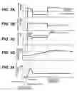 Fig. 04 - Direct injection engine system and start-up method for direct injection engine