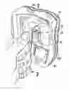 Fig. 01 - Soft pad picture mount