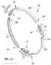 Fig. 17 - Expansion ring assembly