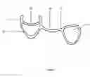 Fig. 02 - Wheelchair wheel