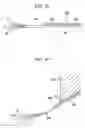 Fig. 45 - Contact probe and probe device