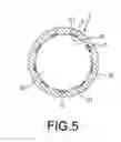 Fig. 06 - Self-lubricating bearing and method of producing the same