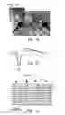 Fig. 02 - Nucleic acid constructs and cells, and methods utilizing same for modifying the electrophysiological function of excitable tissues