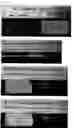 Fig. 07 - Carrier with solid fibrinogen and solid thrombin